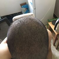 發(fā)際線用戶圖片
