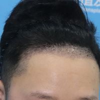 發(fā)際線用戶圖片