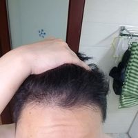 發(fā)際線用戶圖片