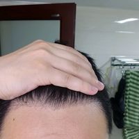 發(fā)際線用戶圖片