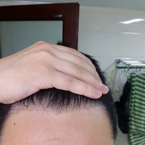发际线分享社区