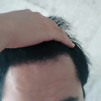 發(fā)際線用戶圖片