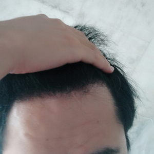 发际线分享社区