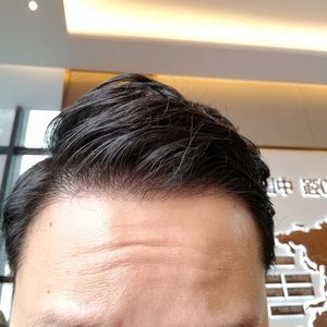 发际线分享社区