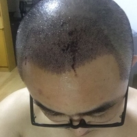 發(fā)際線用戶圖片