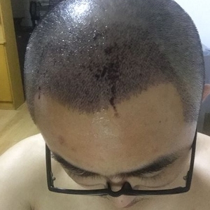 发际线分享社区