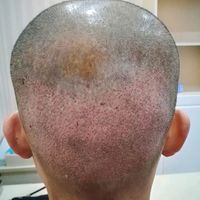 發(fā)際線用戶圖片