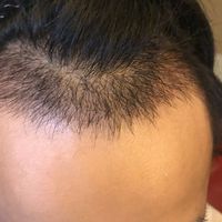 發(fā)際線用戶圖片