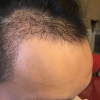 發(fā)際線用戶圖片