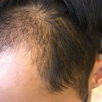 發(fā)際線用戶圖片