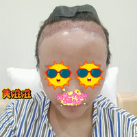 發(fā)際線用戶圖片
