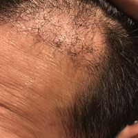 發(fā)際線用戶圖片