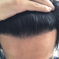 發(fā)際線用戶圖片