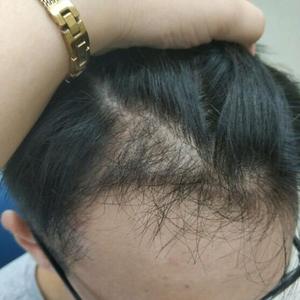 发际线分享社区
