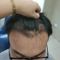 發(fā)際線用戶圖片
