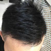 發(fā)際線用戶圖片