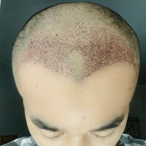 发际线分享社区