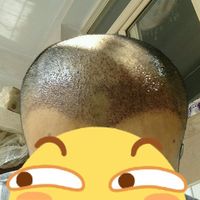 發(fā)際線用戶圖片