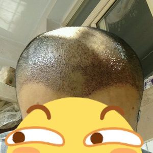 发际线分享社区