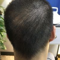 發(fā)際線用戶圖片