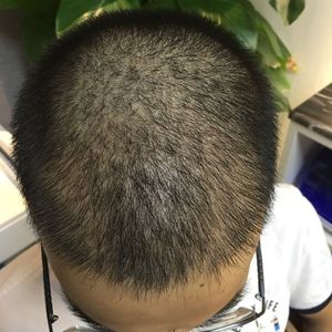 发际线分享社区