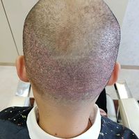 發(fā)際線用戶圖片