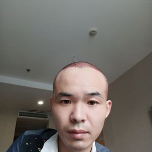 发际线分享社区
