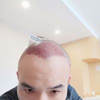 發(fā)際線用戶圖片