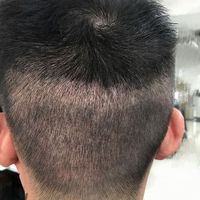發(fā)際線用戶圖片