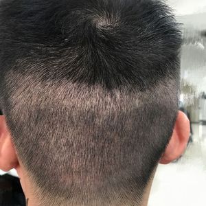 发际线分享社区