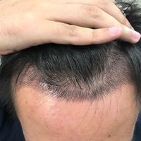 發(fā)際線用戶圖片