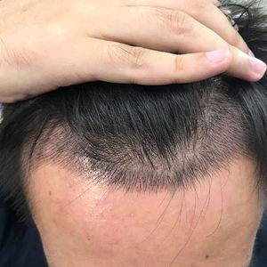 发际线分享社区