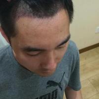發(fā)際線用戶圖片