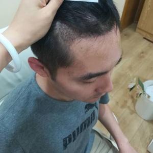 发际线分享社区