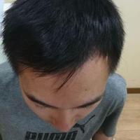 發(fā)際線用戶圖片