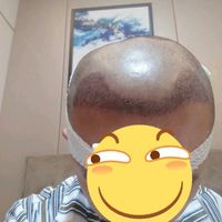 發(fā)際線用戶圖片