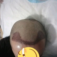 禿頂用戶圖片