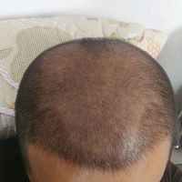 發(fā)際線用戶圖片