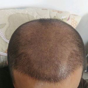 发际线分享社区