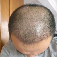 發(fā)際線用戶圖片