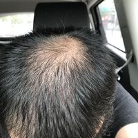 禿頂用戶圖片