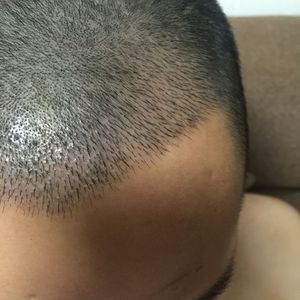 发际线分享社区