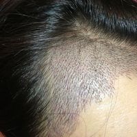 發(fā)際線用戶圖片
