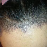 發(fā)際線用戶圖片