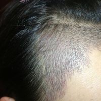 發(fā)際線用戶圖片