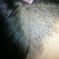 發(fā)際線用戶圖片