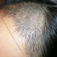 發(fā)際線用戶圖片