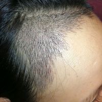 發(fā)際線用戶圖片