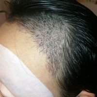 發(fā)際線用戶圖片