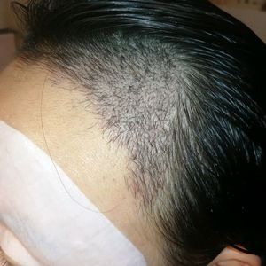 发际线分享社区
